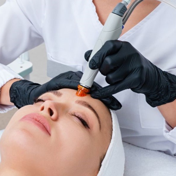 Mikrodermabrázió Budapest