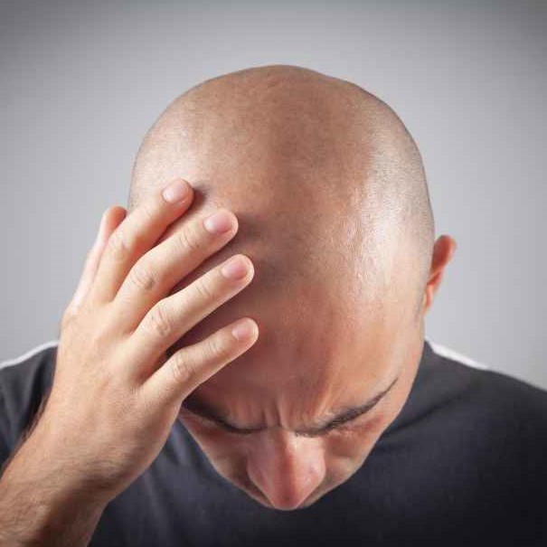 fejbor pigmentalas férfiaknak velemeny