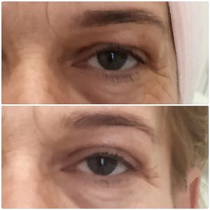 termikus ionizacio Budapest legjobb